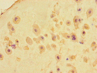 MEIKIN Antibody