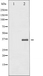 NFKBIB Antibody