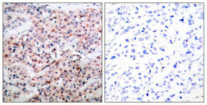 Phospho-BCL2 (Thr56) Antibody