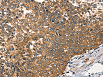 AGO1 Antibody