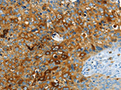 ASAH1 Antibody