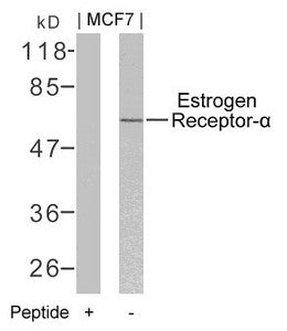 ESR1 (Ab-106) Antibody