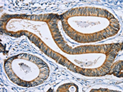 SULT1B1 Antibody