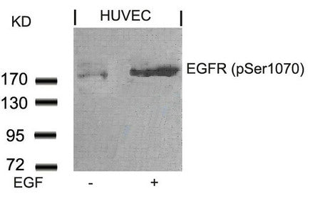 Phospho-EGFR (Ser1070) Antibody