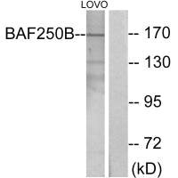 ARID1B Antibody