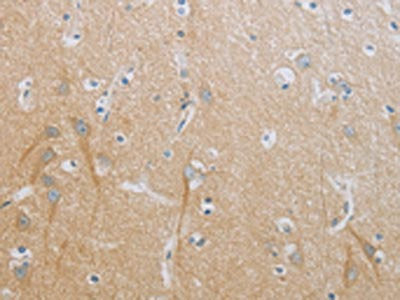 TNFRSF11B Antibody