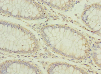 CPD Antibody