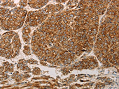 PRDX3 Antibody