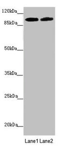 PDE6A Antibody