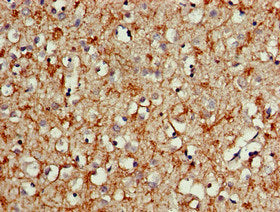 ALK Antibody