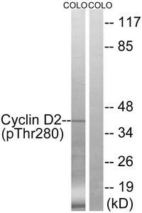 Phospho-CCND2 (Thr280) Antibody