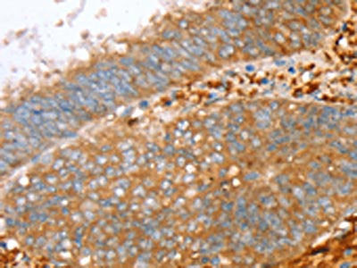 PTPN7 Antibody