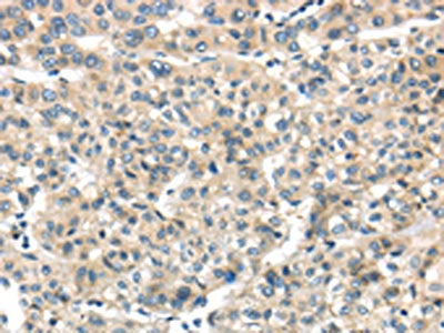 THAP2 Antibody