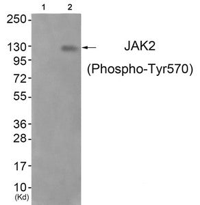 Phospho-JAK2 (Tyr570) Antibody