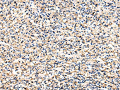 VCAM1 Antibody