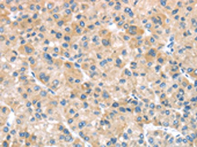 SFTPA1 Antibody