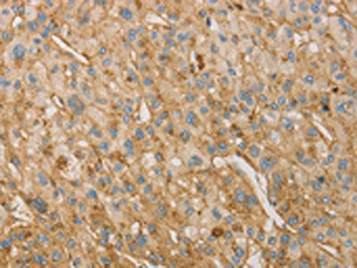 VTN Antibody