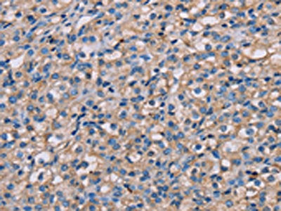 NMT2 Antibody