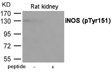 Phospho-NOS2 (Tyr151) Antibody