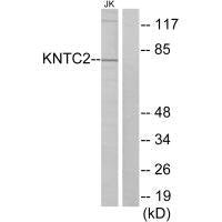 NDC80 Antibody