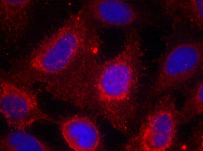 NTRK1 (Ab-791) Antibody