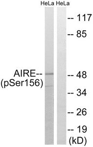 Phospho-AIRE (Ser156) Antibody