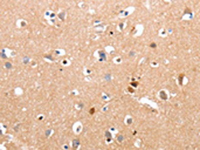 RALB Antibody