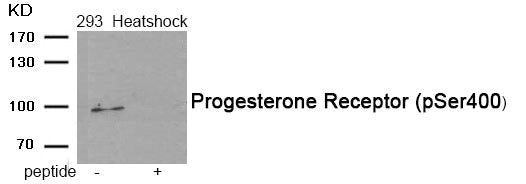 Phospho-PGR (Ser400) Antibody