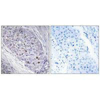 MEF2C Antibody