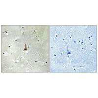 LRP10 Antibody