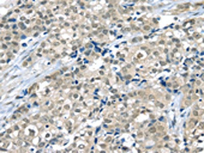 THAP4 Antibody