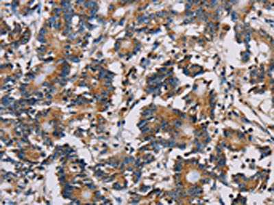 MRPL39 Antibody