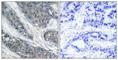 Phospho-IRS1 (Ser307) Antibody
