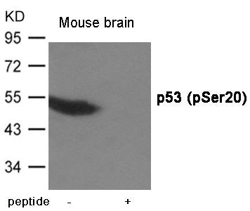 Phospho-TP53 (Ser20) Antibody