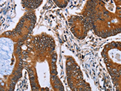 IHH Antibody