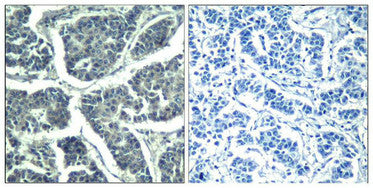 Phospho-PLCG2 (Tyr1217) Antibody