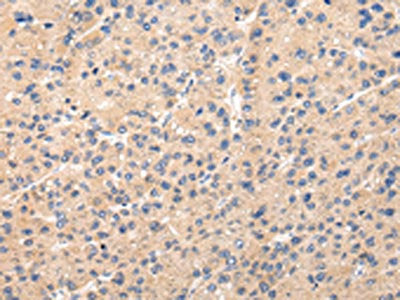 PPP5C Antibody
