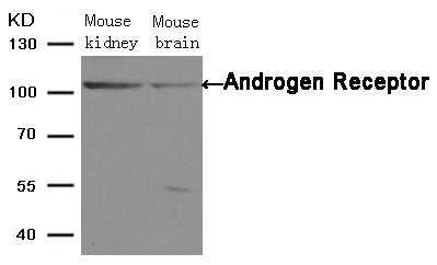 AR (Ab-650) Antibody