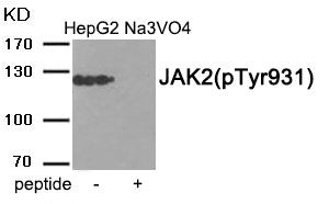 Phospho-JAK2 (Tyr931) Antibody