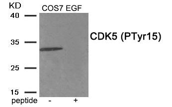 Phospho-CDK5 (Tyr15) Antibody