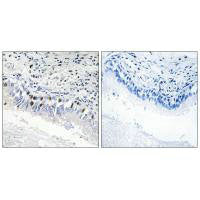 MED12 Antibody