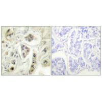 HSPD1 Antibody