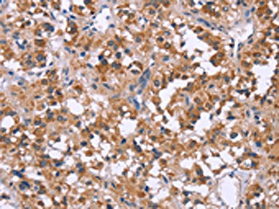 APAF1 Antibody