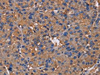 NCSTN Antibody