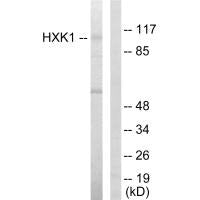 HK1 Antibody