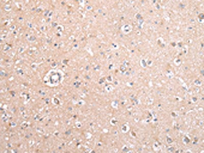 GJB5 Antibody