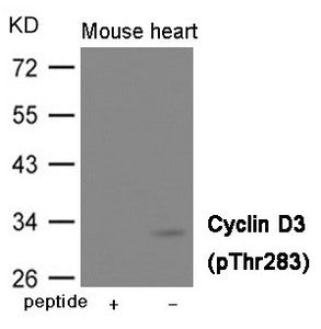 Phospho-CCND3 (Thr283) Antibody