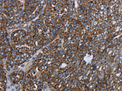 NDUFA13 Antibody