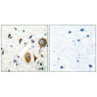 GRM8 Antibody