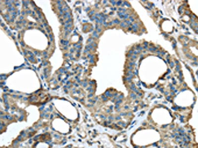 ERP44 Antibody